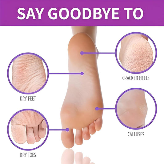 Foot Peeling Mask (1 Pair), Korean Peeling & Exfoliating | Deep Exfoliation with Glycolic Acid, Removes Dead Skin, Cruelty-Free, Foot Peel Off Mask (1 Pair Foots Masks - Lavender)