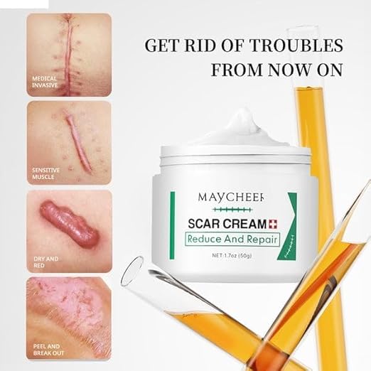 Scar cream for surgical scars | acne scar treatment scar removal sream | silicone scar cream for dark spots & acne marks | body scar repair cream