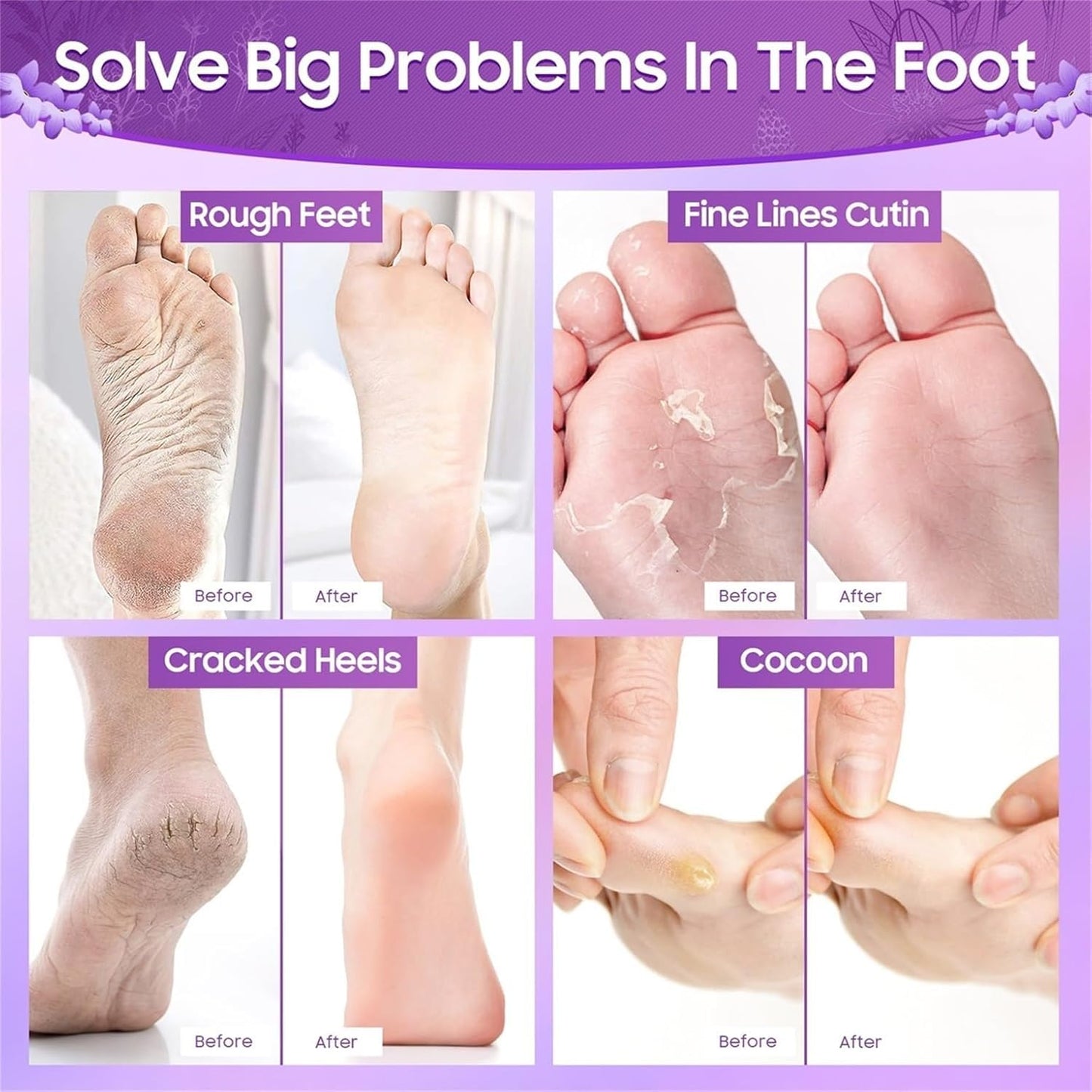 KLIFFOO Glycolic Acid Foot Peeling Mask 2 Pair, Korean Peeling & Exfoliating Foot Peel Off Mask for Rough, Dry & Cracked Heel, Feet Repair Socks Removes Dead Skin & Callus Remover, Cruelty-Free