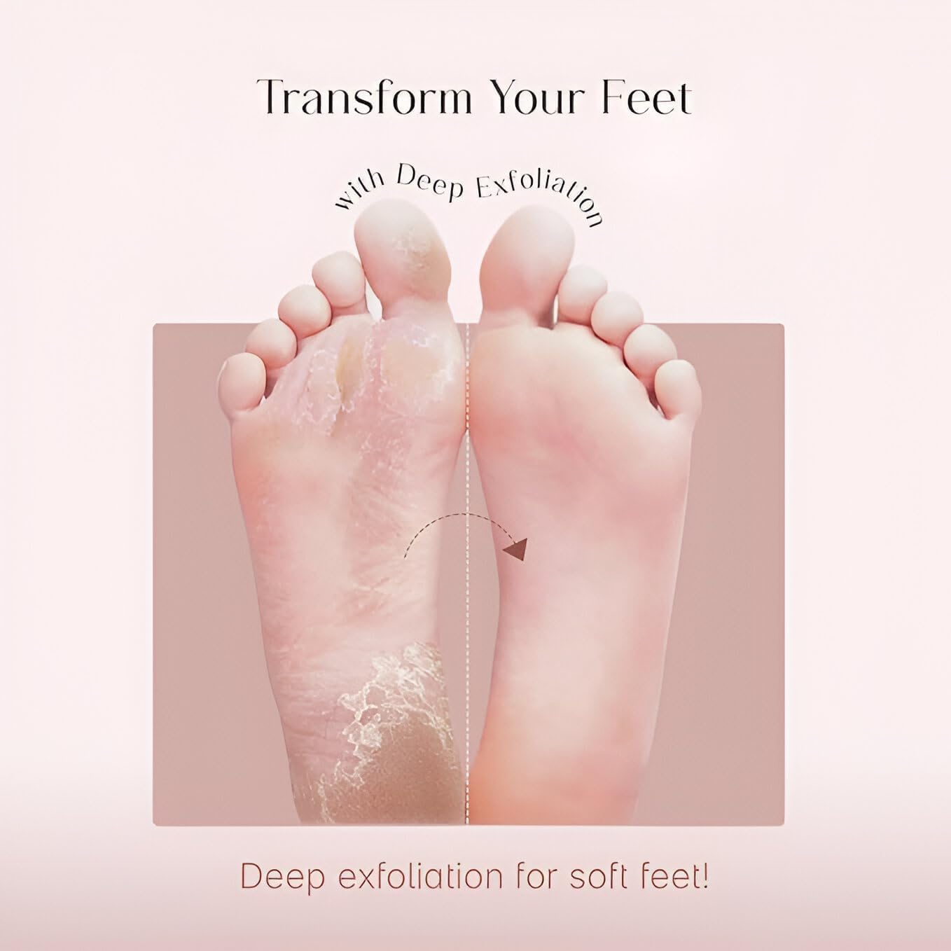 Foot Peeling Mask (1 Pair), Korean Peeling & Exfoliating | Deep Exfoliation with Glycolic Acid, Removes Dead Skin, Cruelty-Free, Foot Peel Off Mask (1 Pair Foots Masks - Lavender)