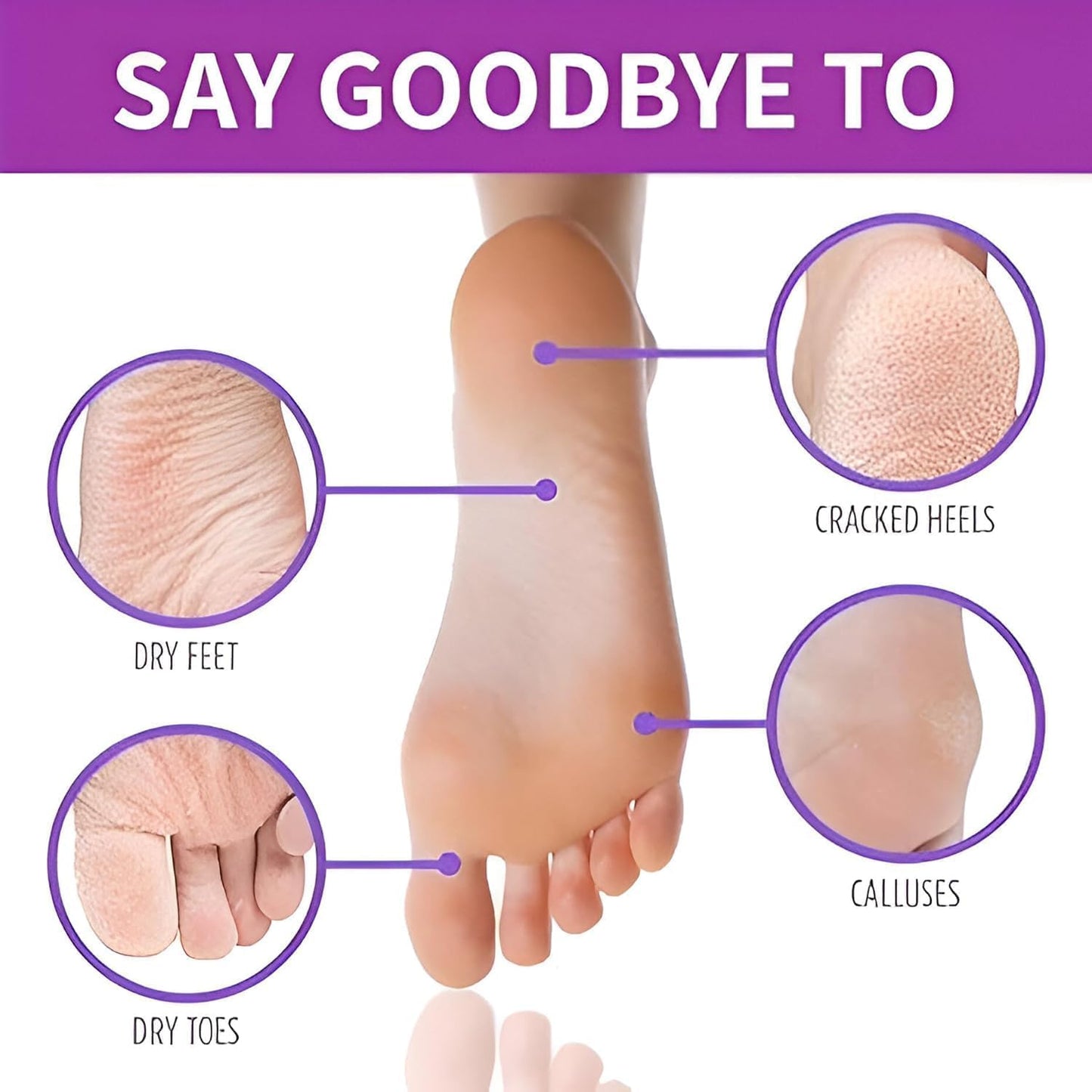 Foot Peeling Mask (1 Pair), Korean Peeling & Exfoliating | Deep Exfoliation with Glycolic Acid, Removes Dead Skin, Cruelty-Free, Foot Peel Off Mask (1 Pair Foots Masks - Lavender)