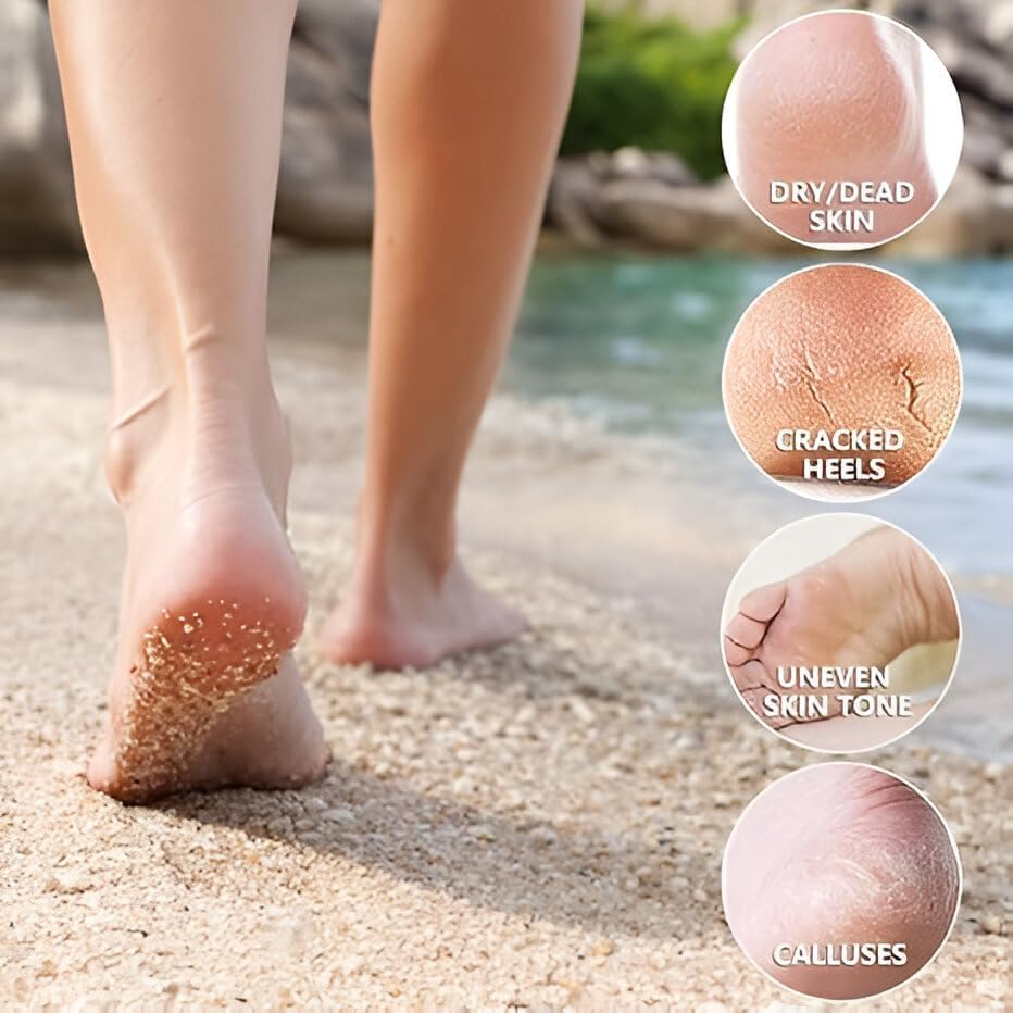 Foot Peeling Mask (1 Pair), Korean Peeling & Exfoliating | Deep Exfoliation with Glycolic Acid, Removes Dead Skin, Cruelty-Free, Foot Peel Off Mask (1 Pair Foots Masks - Lavender)