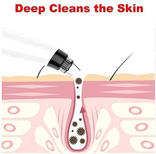 4 in 1 Multi-function Blackhead Remover Tools | Electric Derma suction Machine | Acne Pimple Pore Cleaner Vacuum Tool-Device for Nose & Skin Care