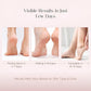 Foot Peeling Mask (1 Pair), Korean Peeling & Exfoliating | Deep Exfoliation with Glycolic Acid, Removes Dead Skin, Cruelty-Free, Foot Peel Off Mask (1 Pair Foots Masks - Lavender)