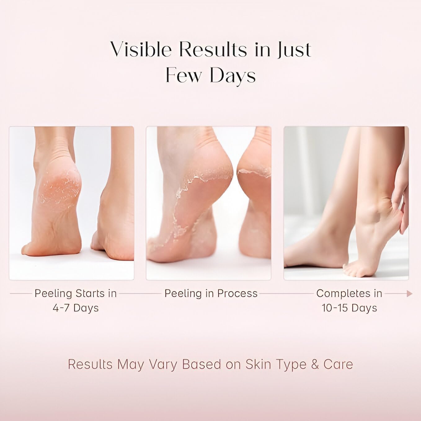Foot Peeling Mask (1 Pair), Korean Peeling & Exfoliating | Deep Exfoliation with Glycolic Acid, Removes Dead Skin, Cruelty-Free, Foot Peel Off Mask (1 Pair Foots Masks - Lavender)