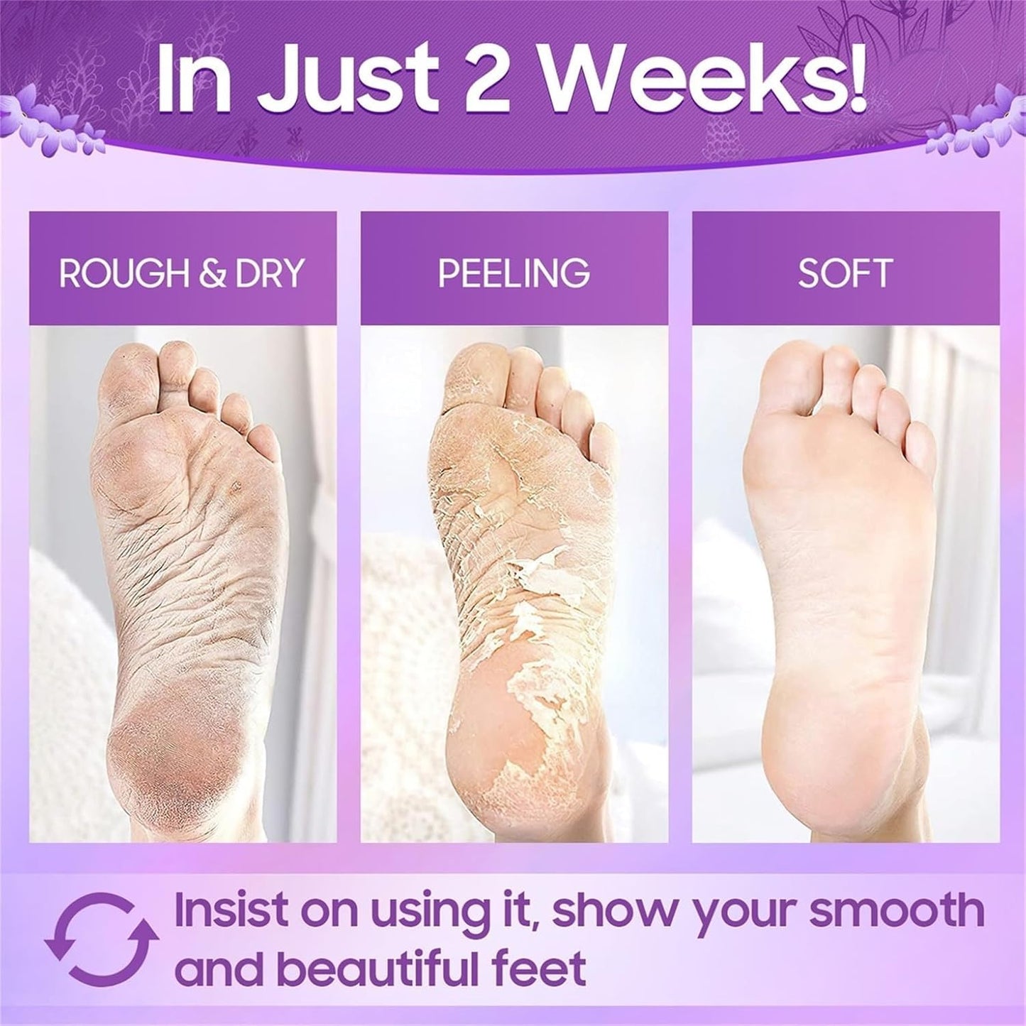 KLIFFOO Glycolic Acid Foot Peeling Mask 2 Pair, Korean Peeling & Exfoliating Foot Peel Off Mask for Rough, Dry & Cracked Heel, Feet Repair Socks Removes Dead Skin & Callus Remover, Cruelty-Free