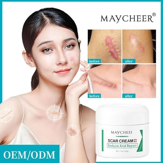 Scar cream for surgical scars | acne scar treatment scar removal sream | silicone scar cream for dark spots & acne marks | body scar repair cream