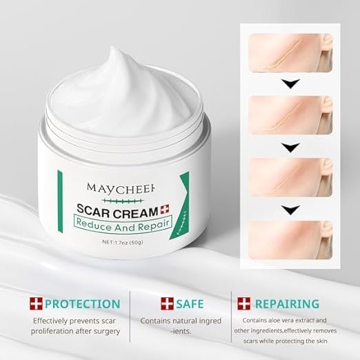 Scar cream for surgical scars | acne scar treatment scar removal sream | silicone scar cream for dark spots & acne marks | body scar repair cream